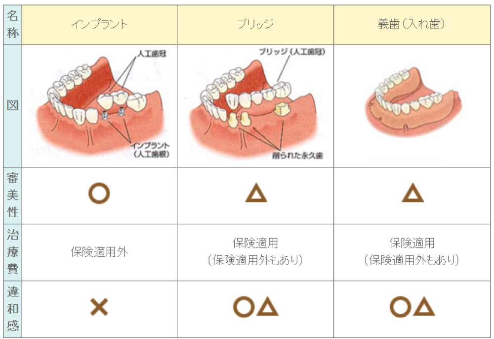 インプラント・ブリッジ・義歯（入れ歯）